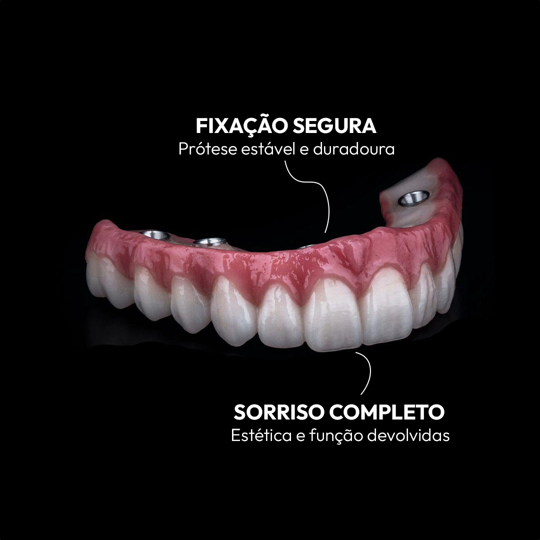 03 - Protese
