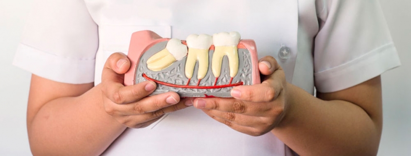 O siso entorta os dentes da frente?