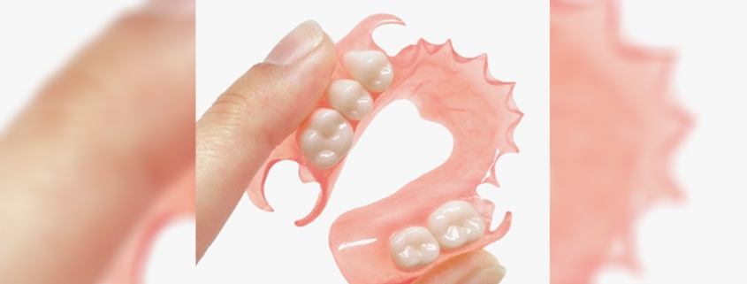 Doutor, quanto tempo demora para a minha prótese ficar pronta?