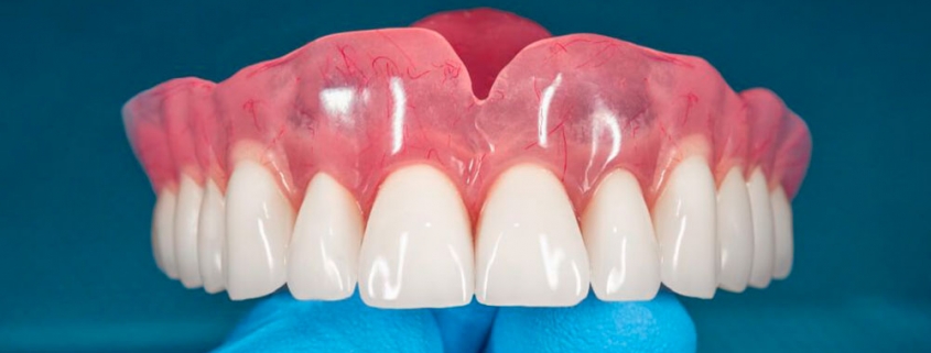 É possível ter uma prótese com o céu da boca livre?