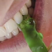 Alimentos inimigos dos dentes