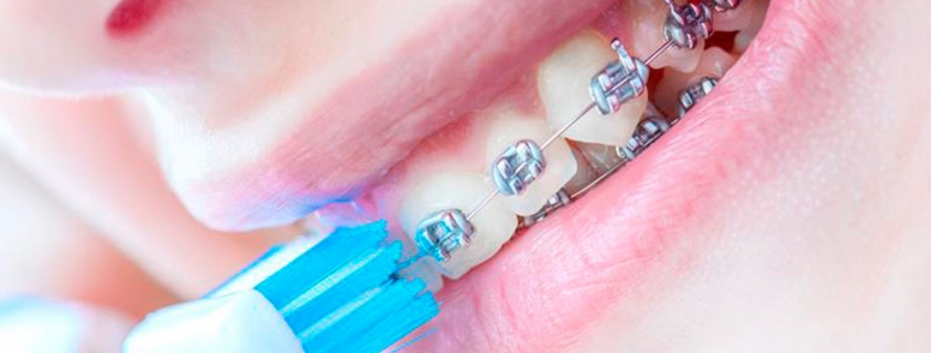 A sua manutenção do aparelho está em dia?