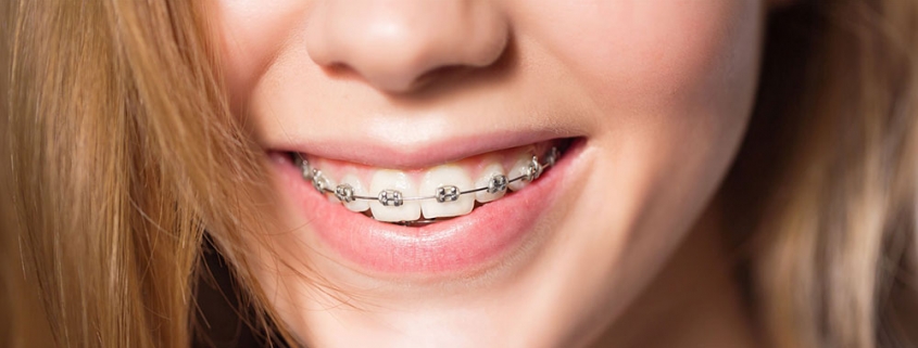 Cuidados com o aparelho