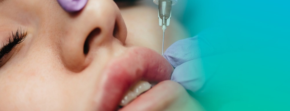 Como é feito preenchimento labial?